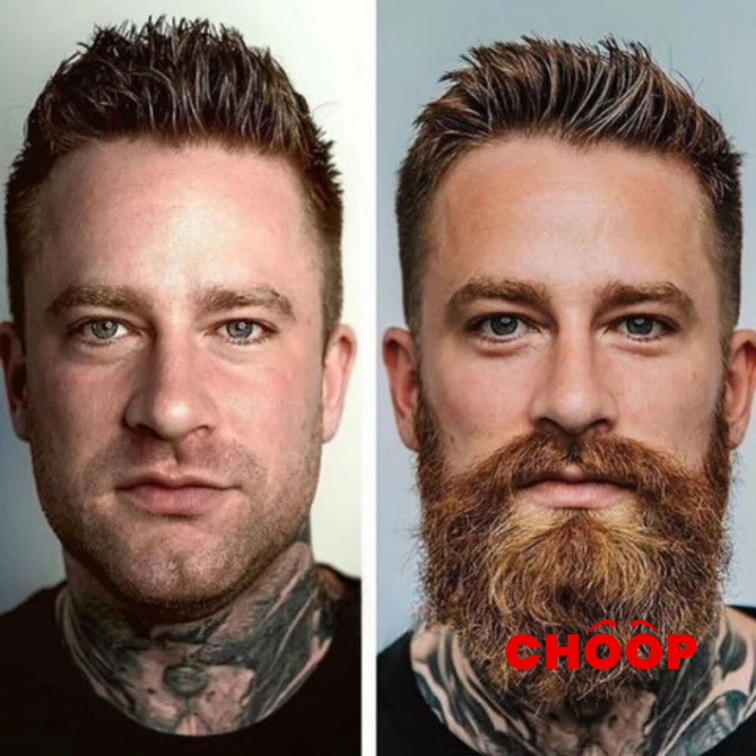 Male Beard® Activador para un hombre Barbado🧔🏻♂️
