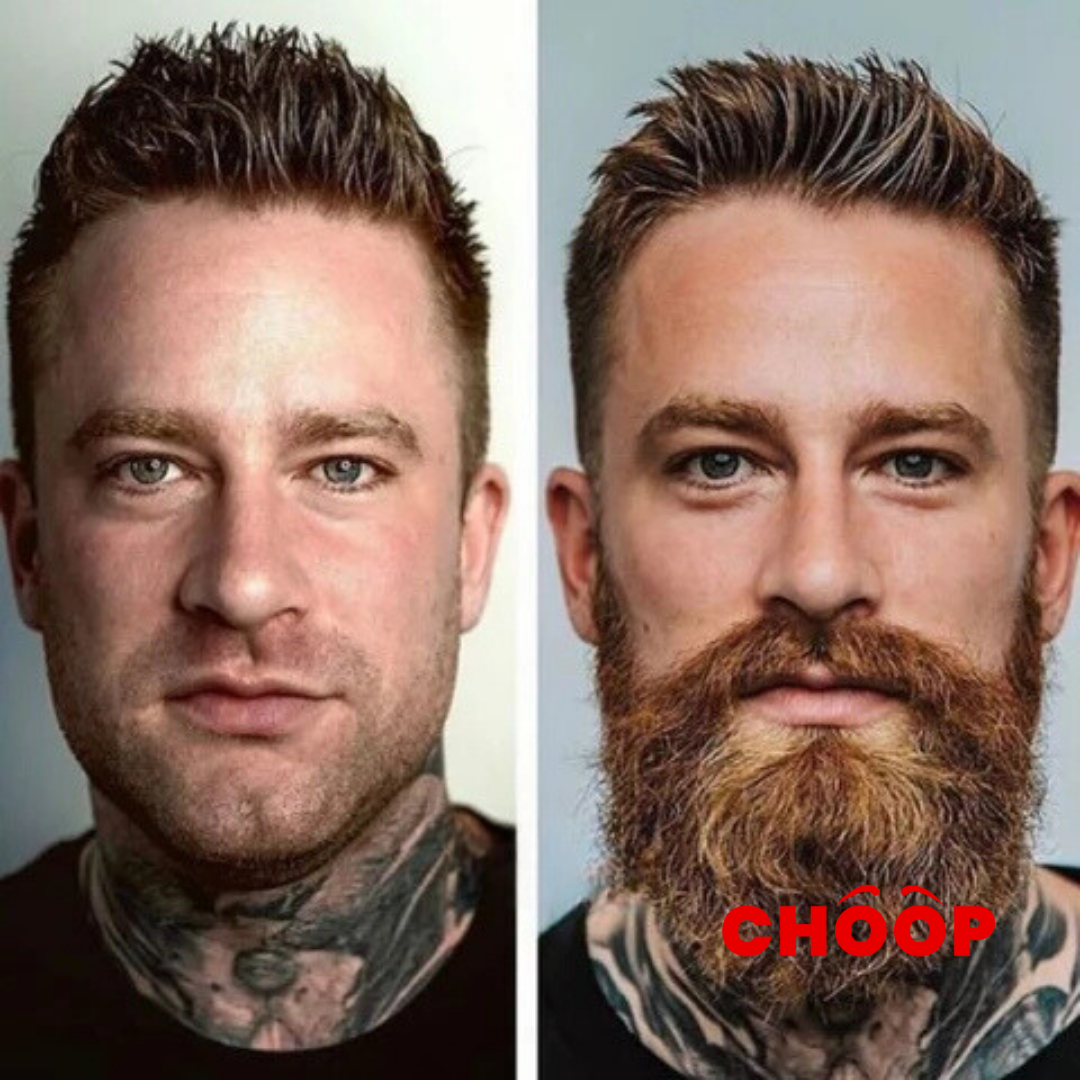 Male Beard®  Activador para un hombre Barbado🧔🏻‍♂️